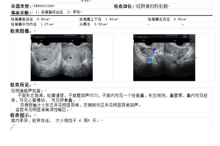 我一万九的血值出胎心胎芽会不会不好还有是小孕