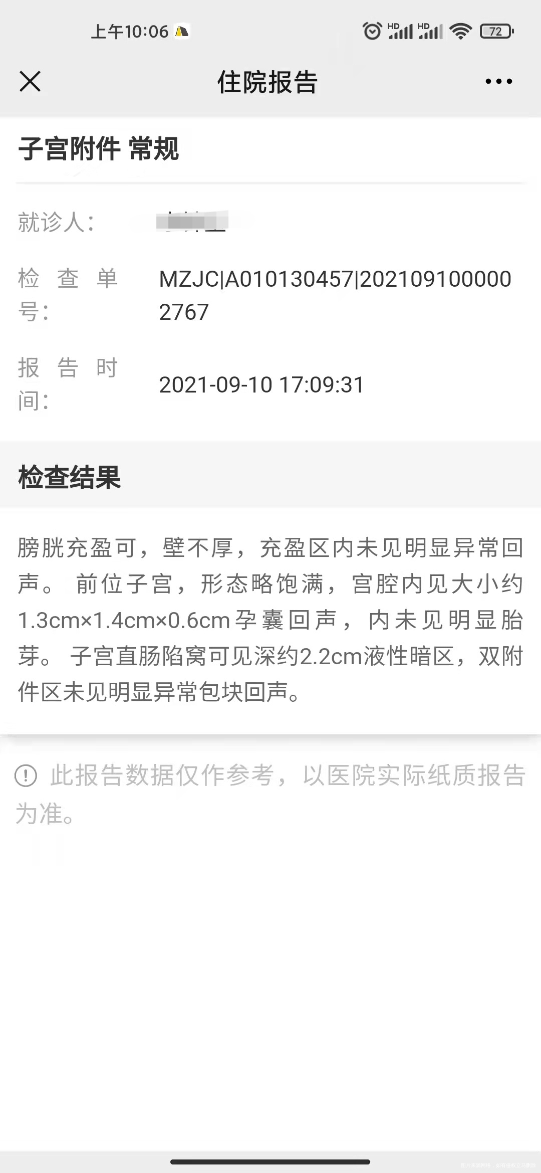 请问医生孕囊为什么变小了怀孕70多天正常吗