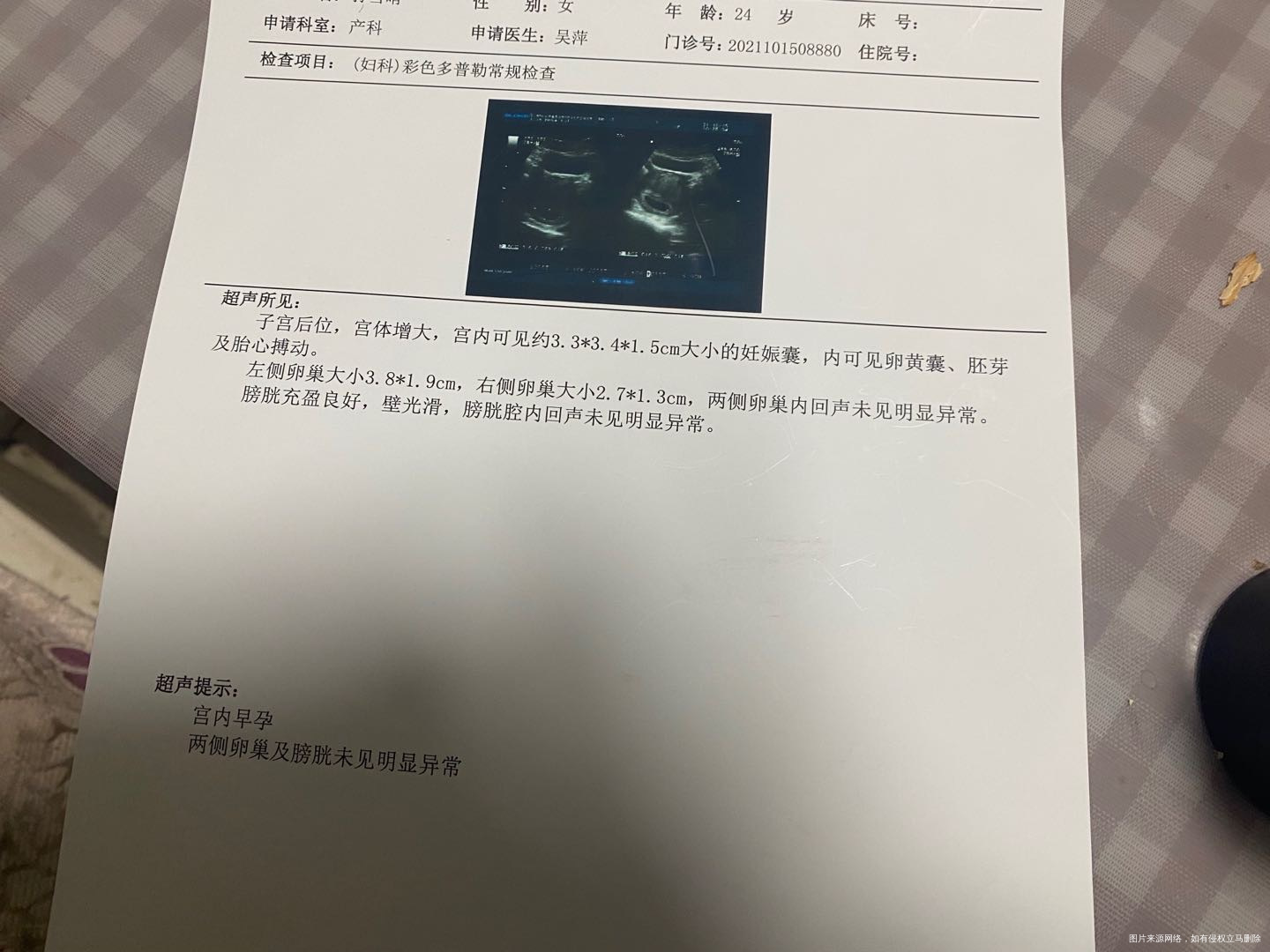 6周➕5天了胎心胎芽都有了我们这边大夫说可以