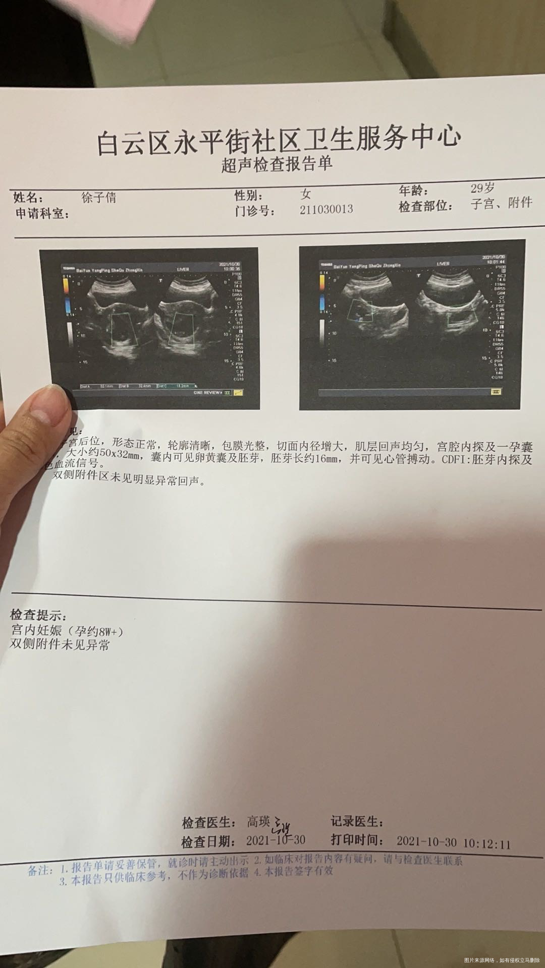 1018号7+1周胚芽10mm今天1030号