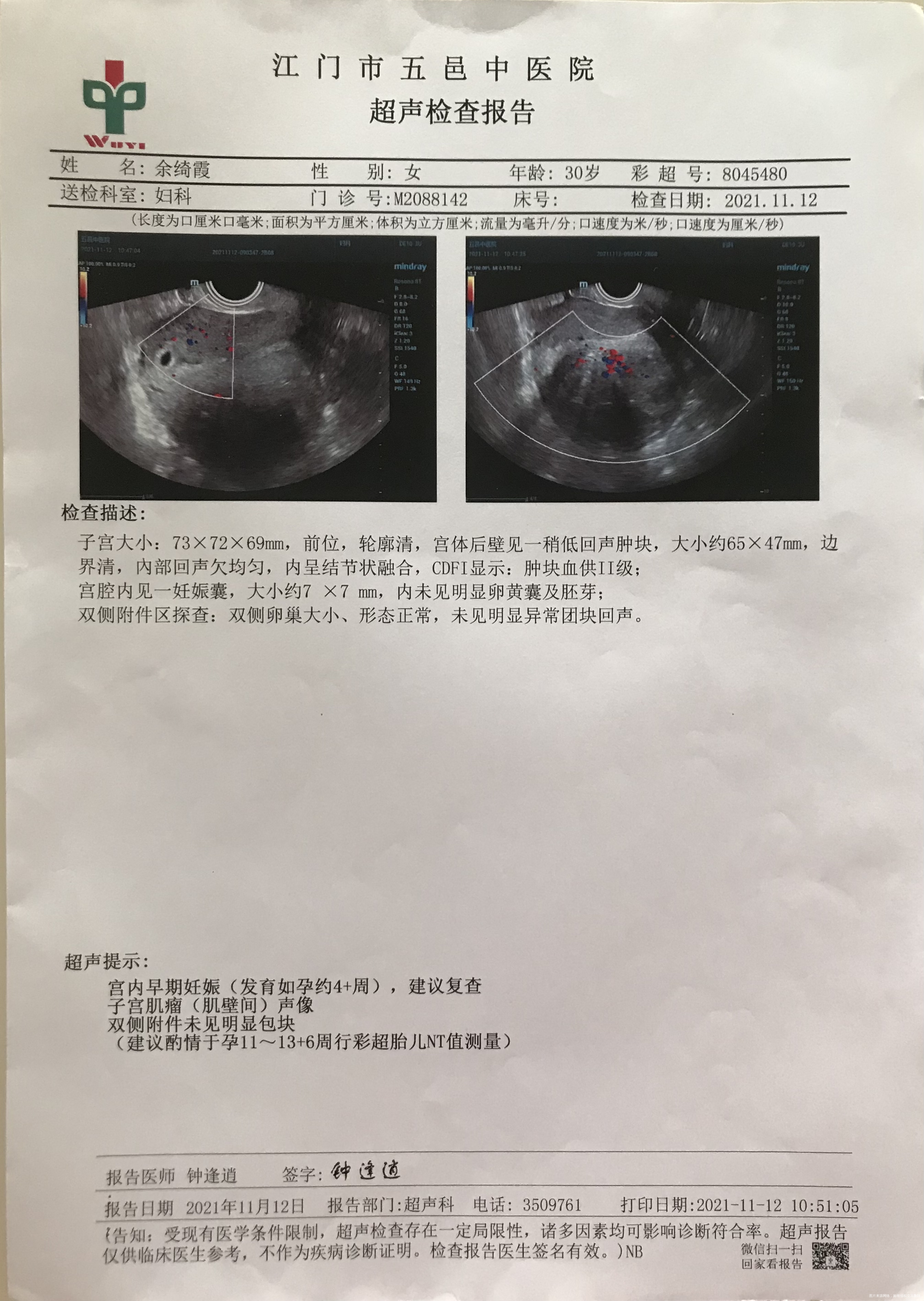 医生好我末次月经是10月10号来前天刚好孕6