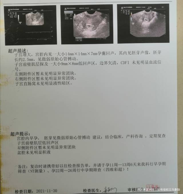 您好11月8移植11月20日验孕HCG185
