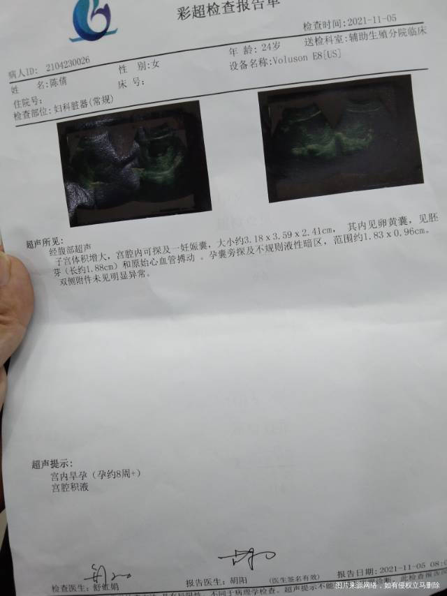 医生我这样需要保胎吗