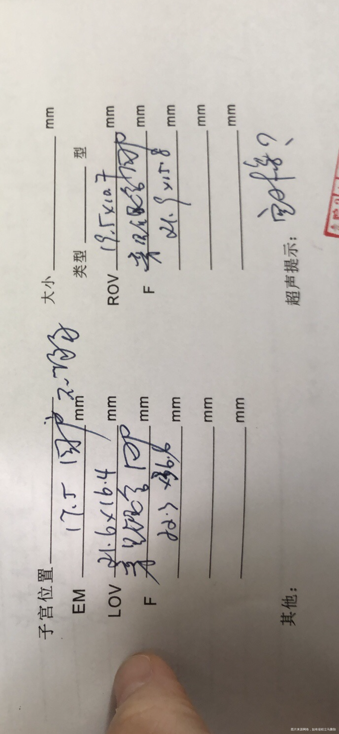 20211021号移植2021114号血值3