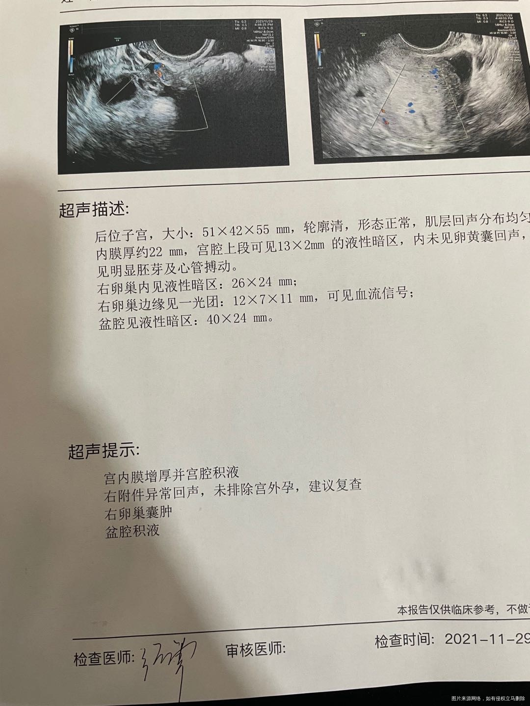 翻倍慢第一次查血1898隔天第二次7086隔