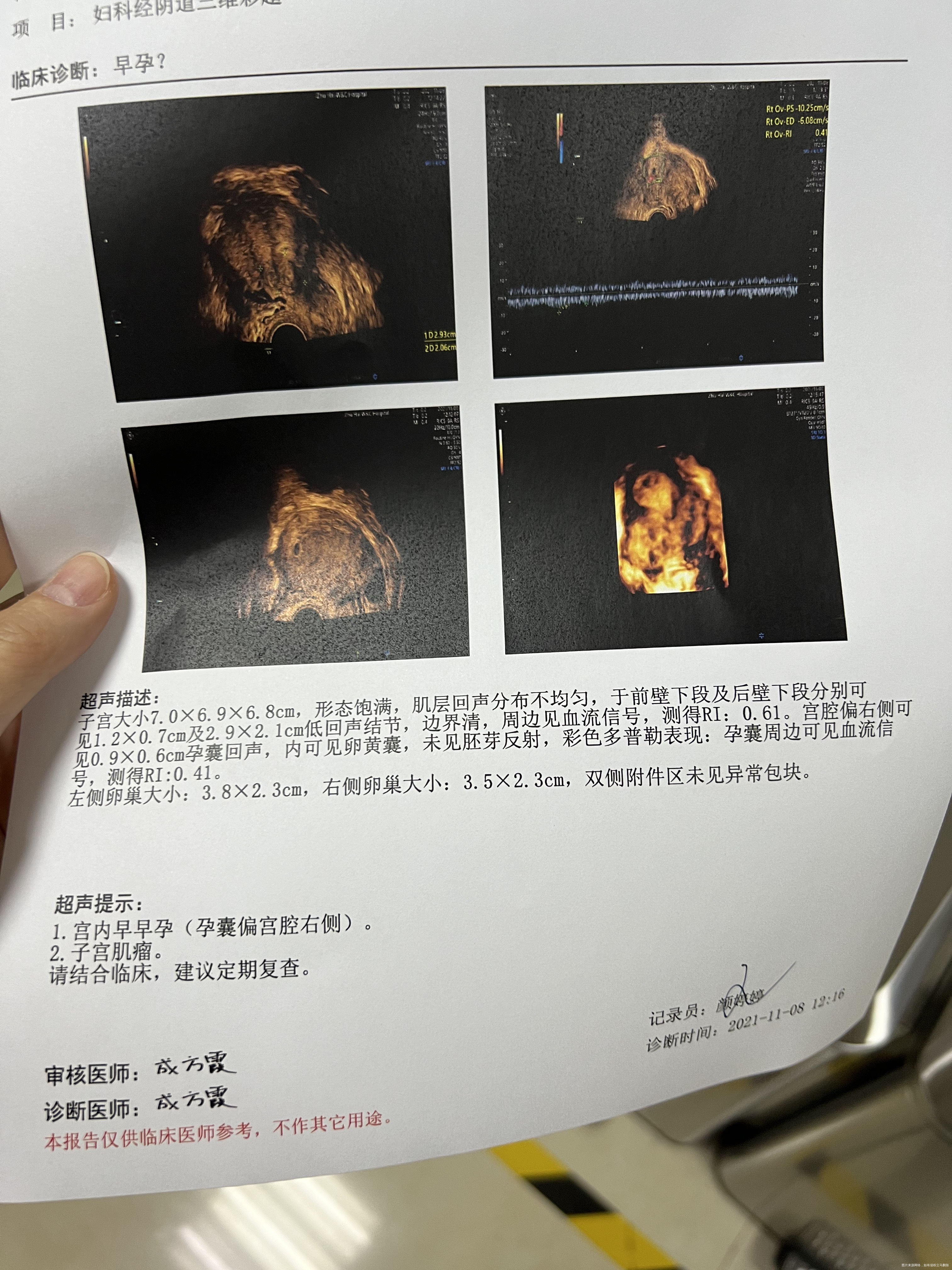 医生你好一代鲜胚10月5号移植10月15号抽