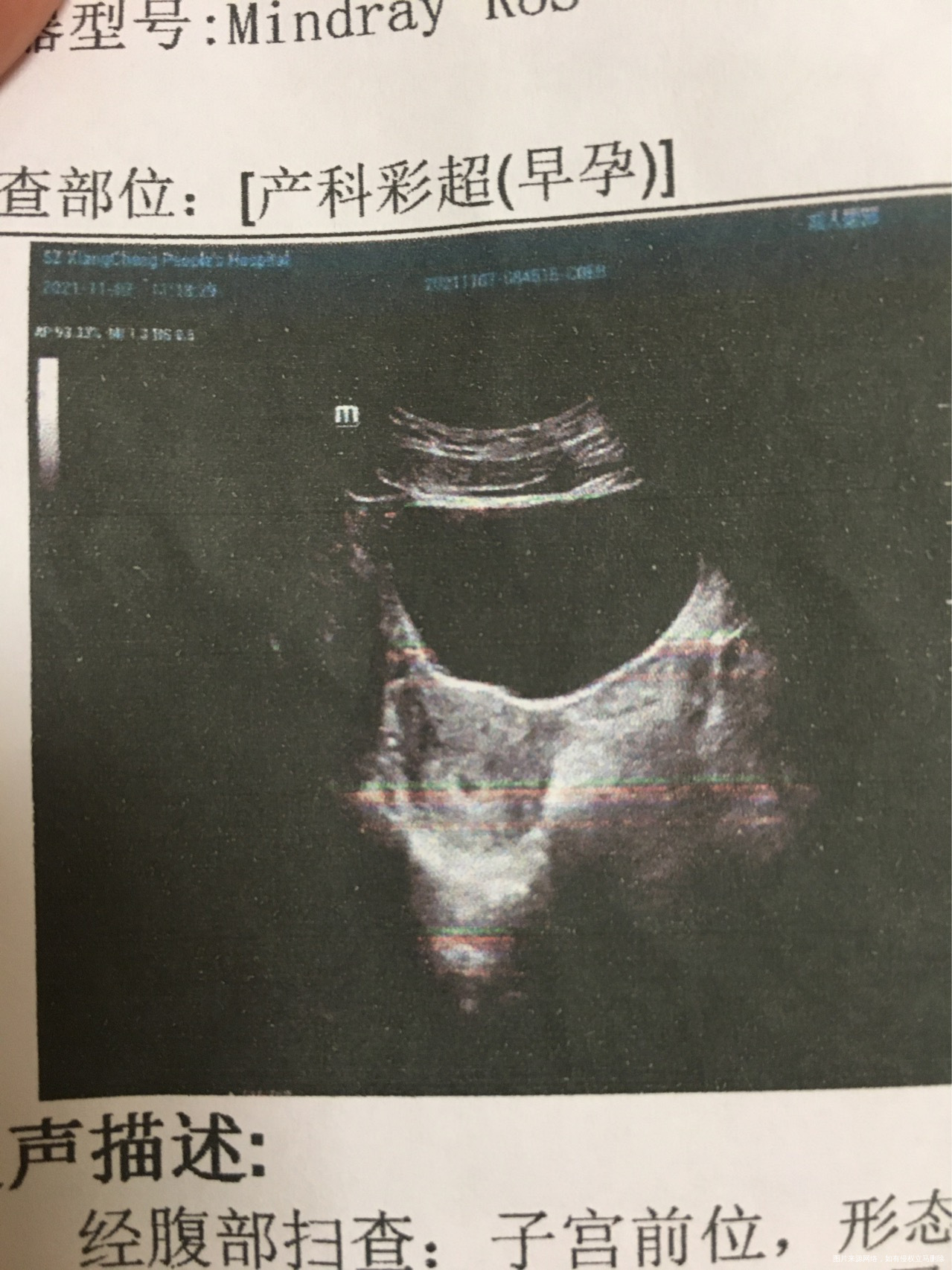 末次月经9月12日18日怀的话应该是在10月