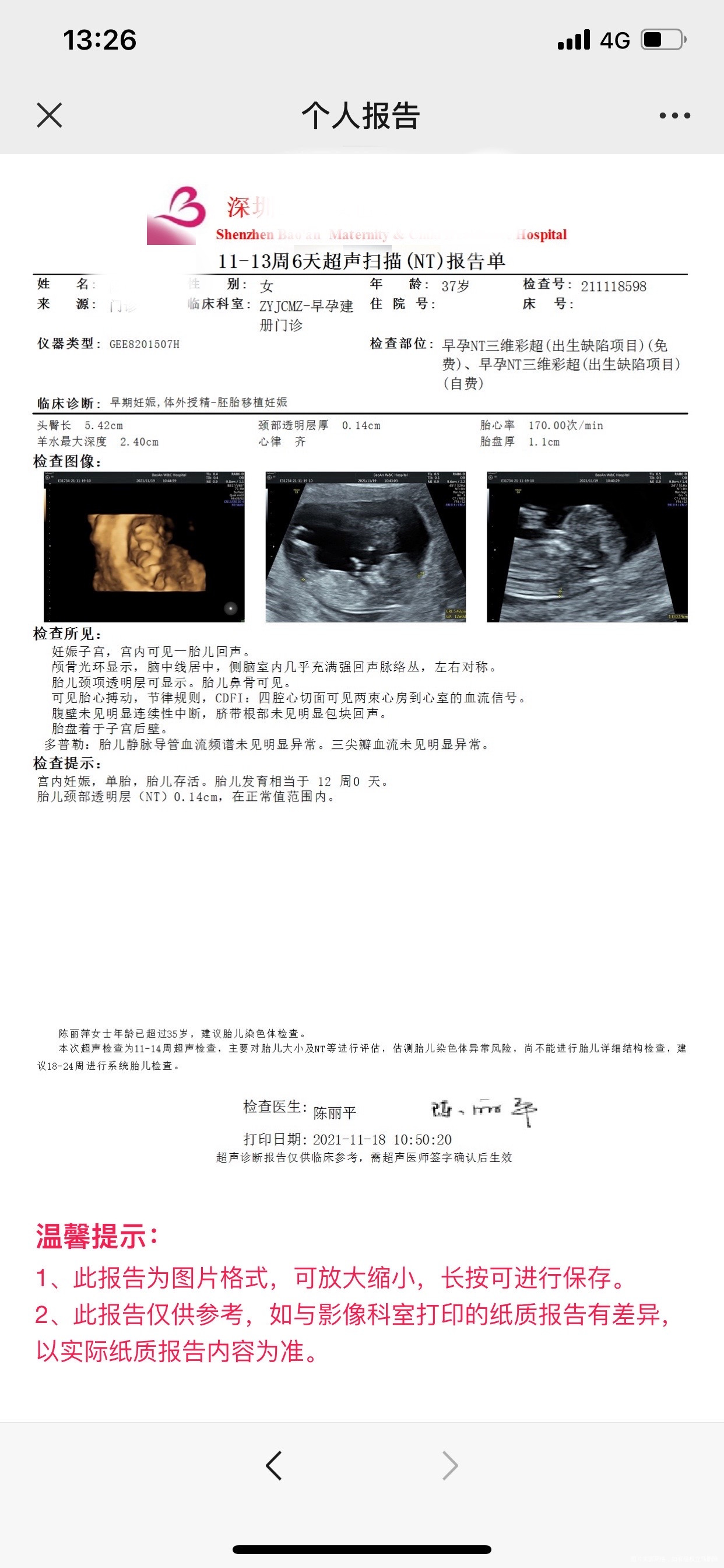 今天起床后小腹就有疼痛了刚好今天要去NT在B