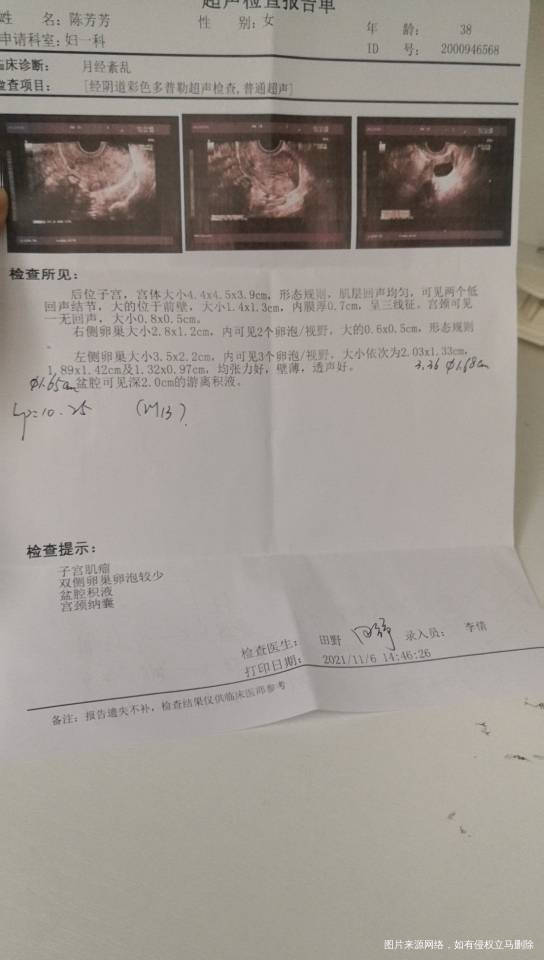 医生您好我卵巢功能查基础就56泡10月26试