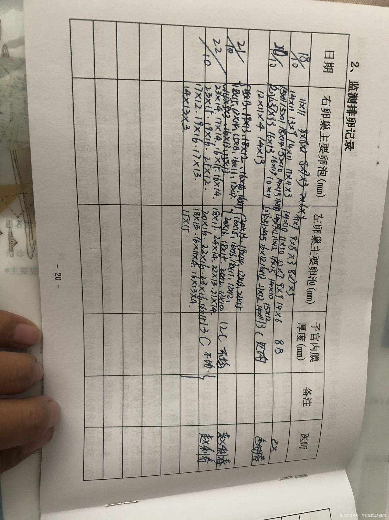 多囊患者经过五次促排一次人授未孕上个月13号