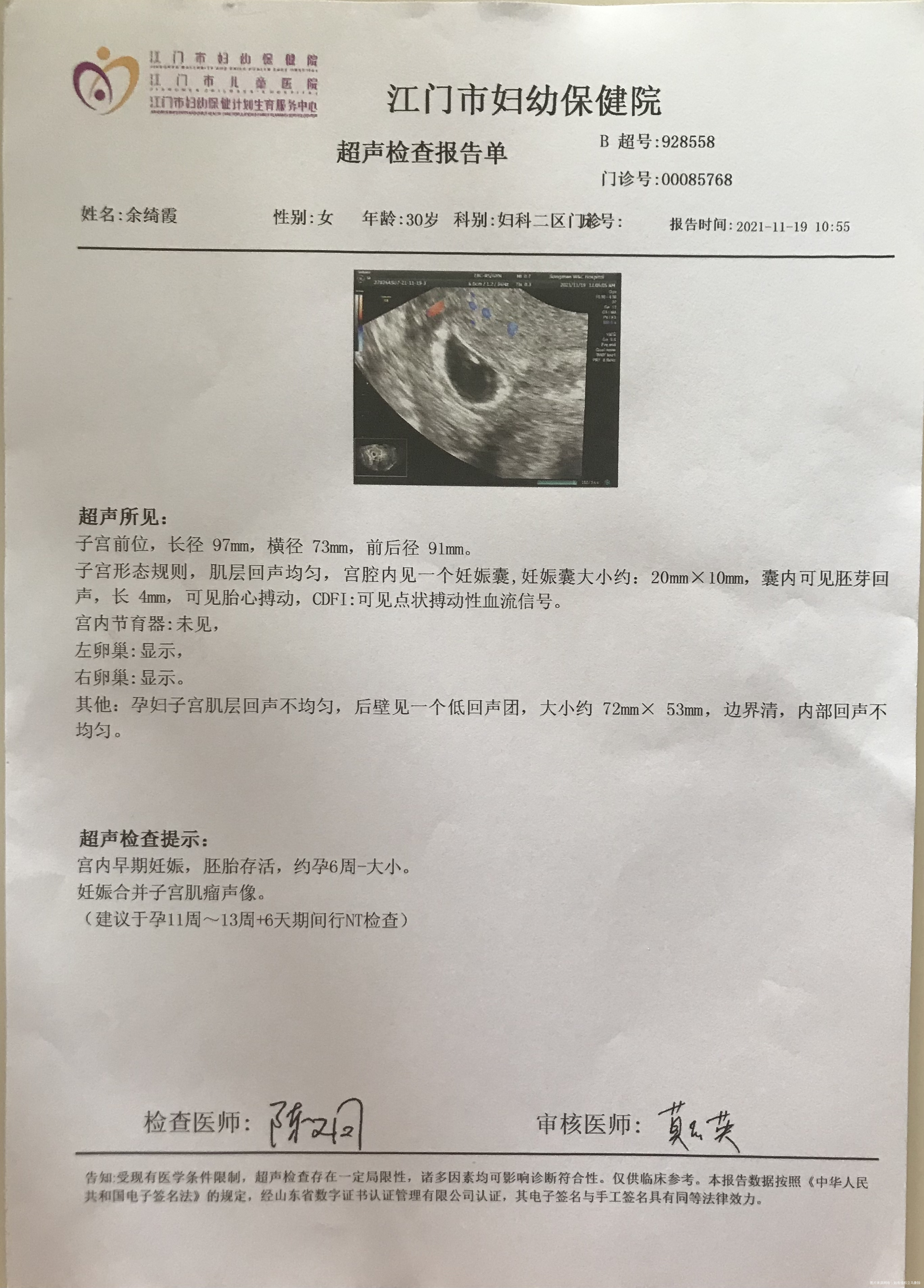 医生好我10月10号末次来月经周期25天今天