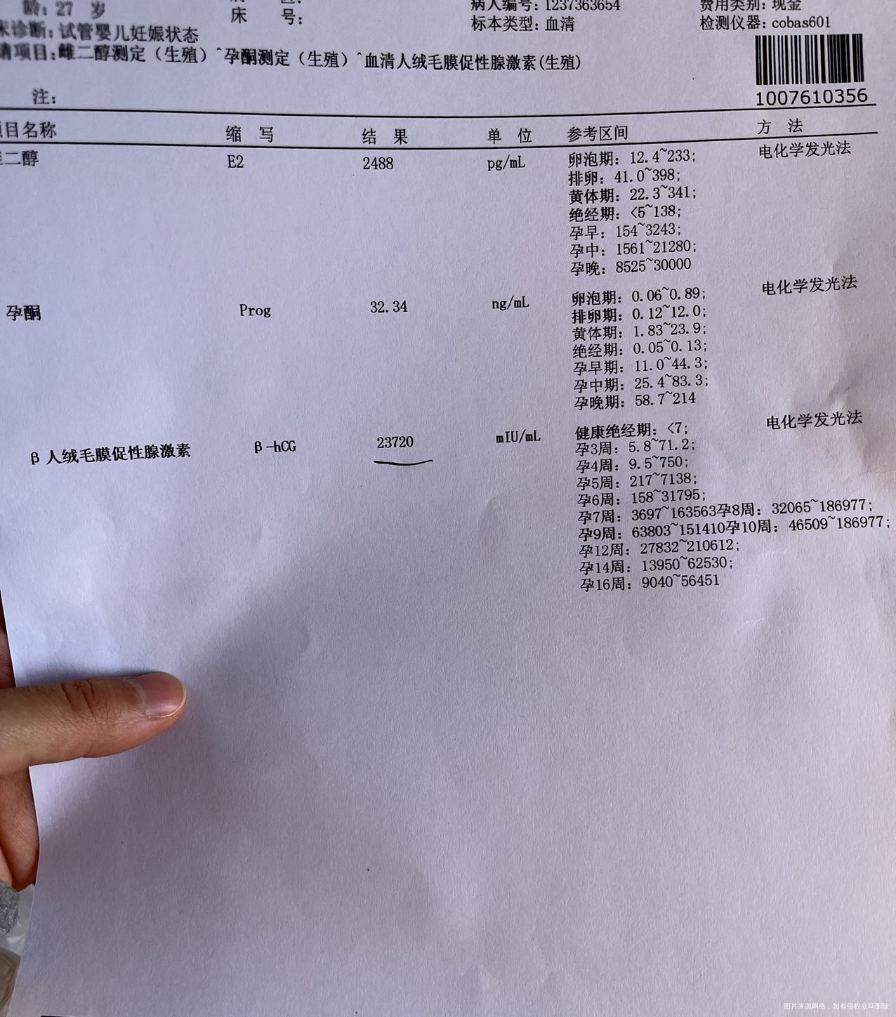 今天是移植的第28天做的检查18号的hcg是