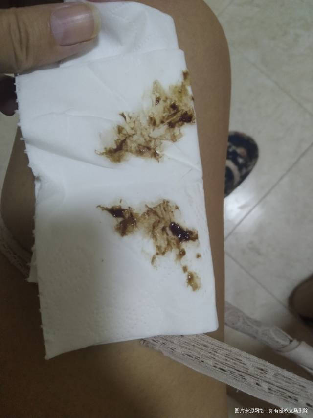 试管怀孕十一周+肚子也没有不舒服早晨起来上厕