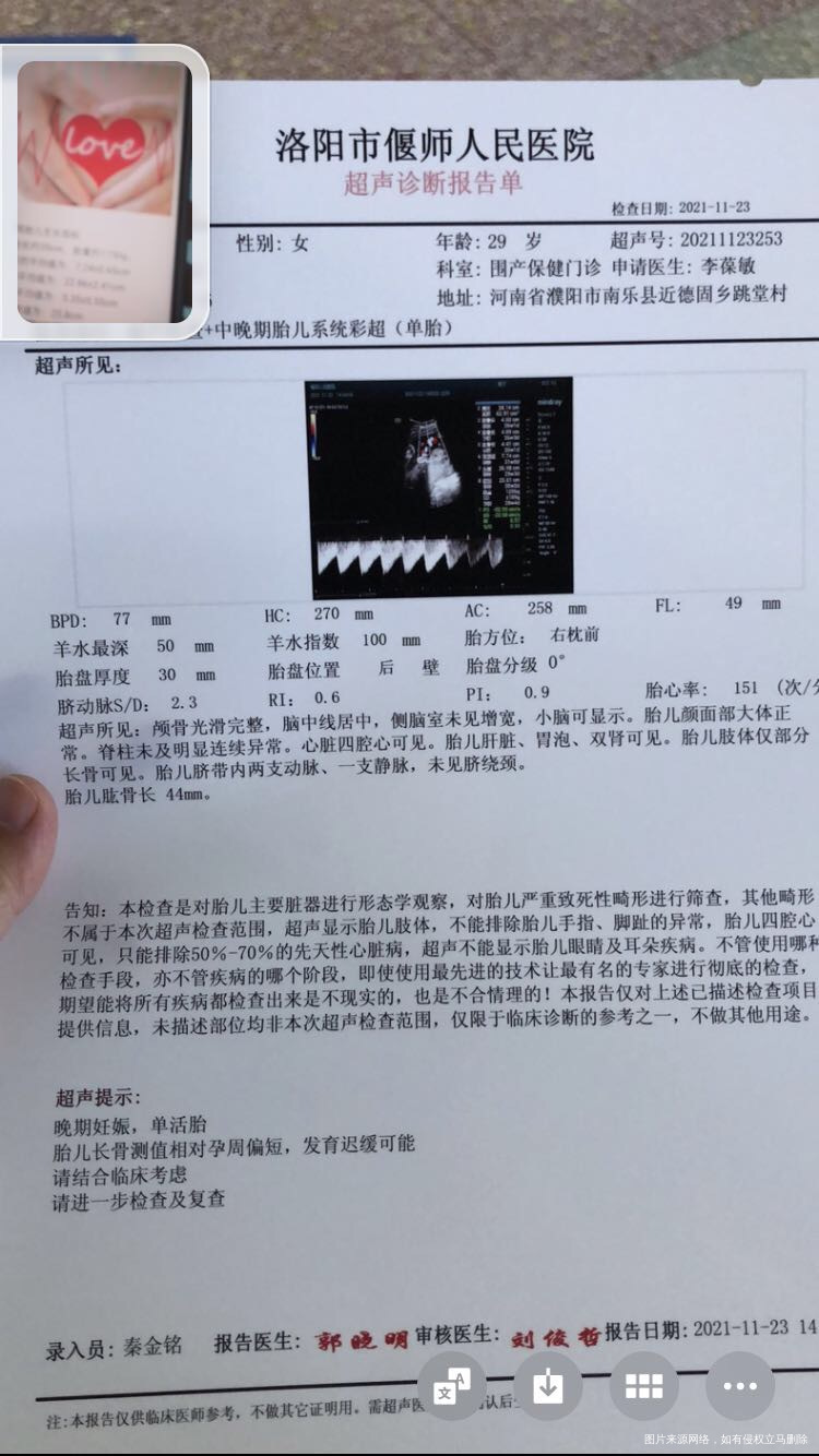 孕28周多长骨偏短是怎么回事怎么处理平时没吃