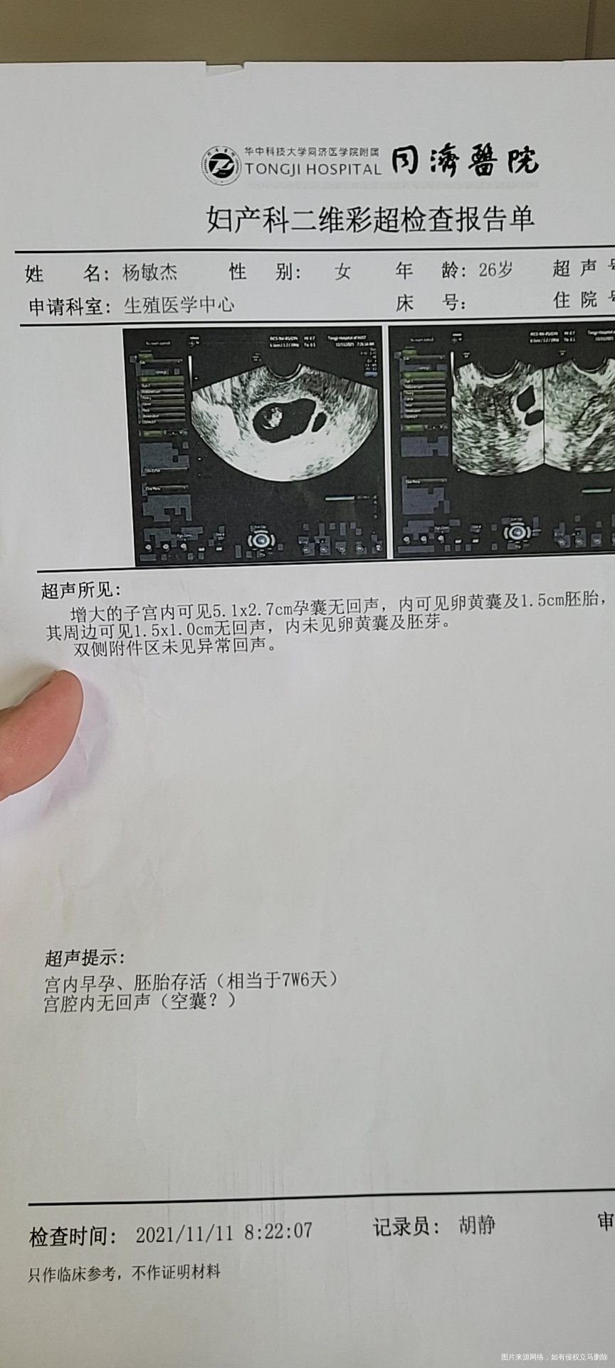 本来怀孕8周+2今天检查只有7周+6小了一点