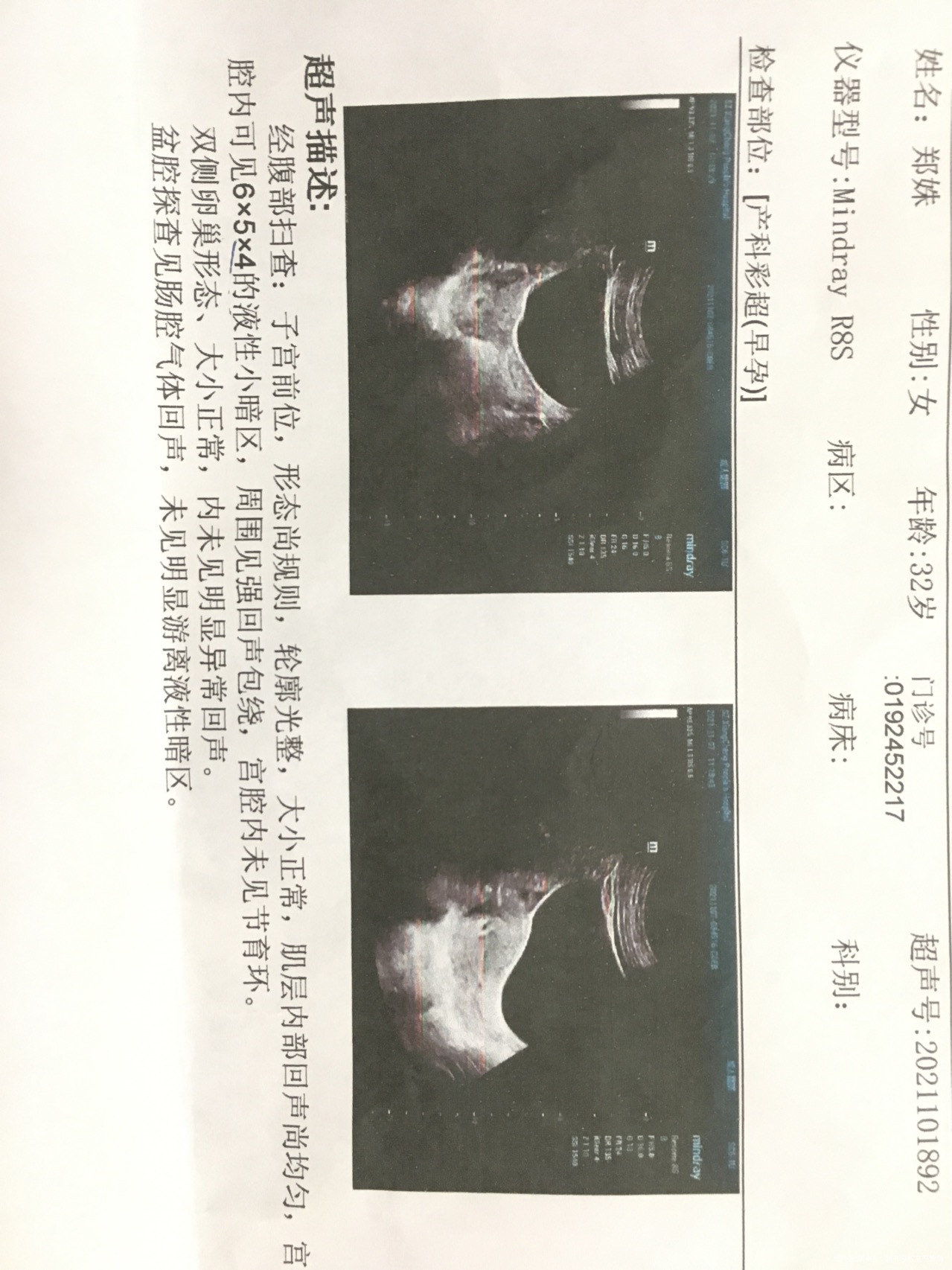 末次月经9月12日18日怀的话应该是在10月