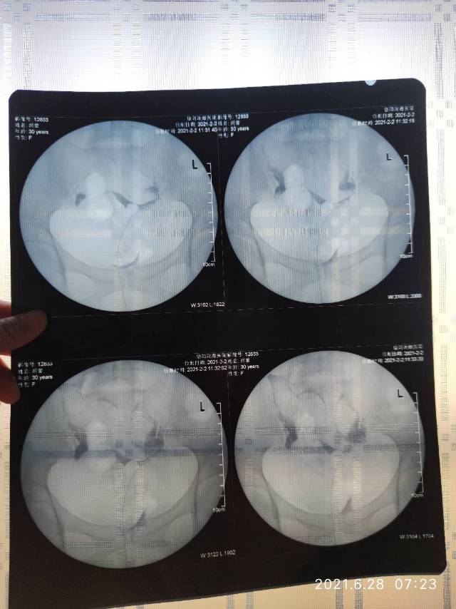我今年30岁备孕大概有五年了一直没怀上201