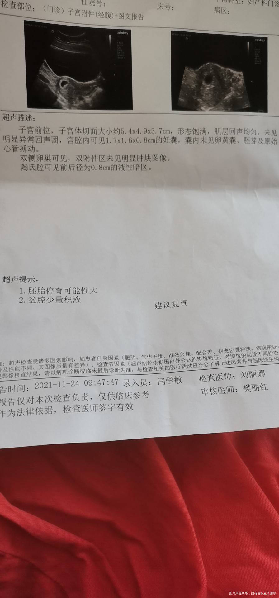 你好医生末次月经9月19日11月17日检查可