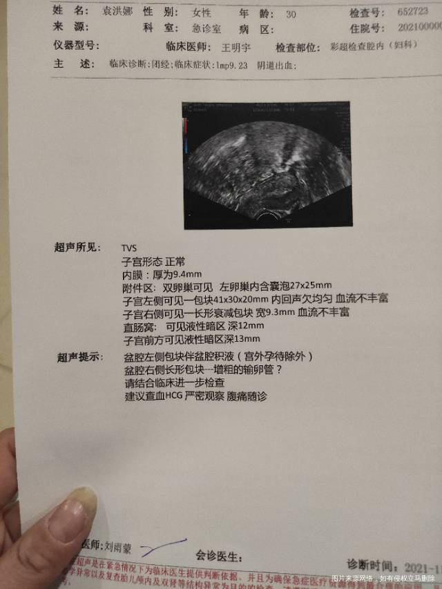 出血20天移植两冻胚我这严重吗害怕