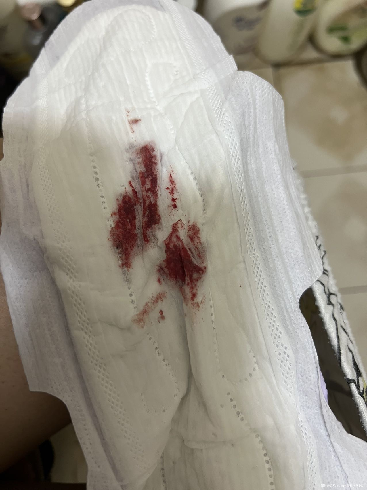 保胎两天还一直流血需要去医院检查吗还是保胎药