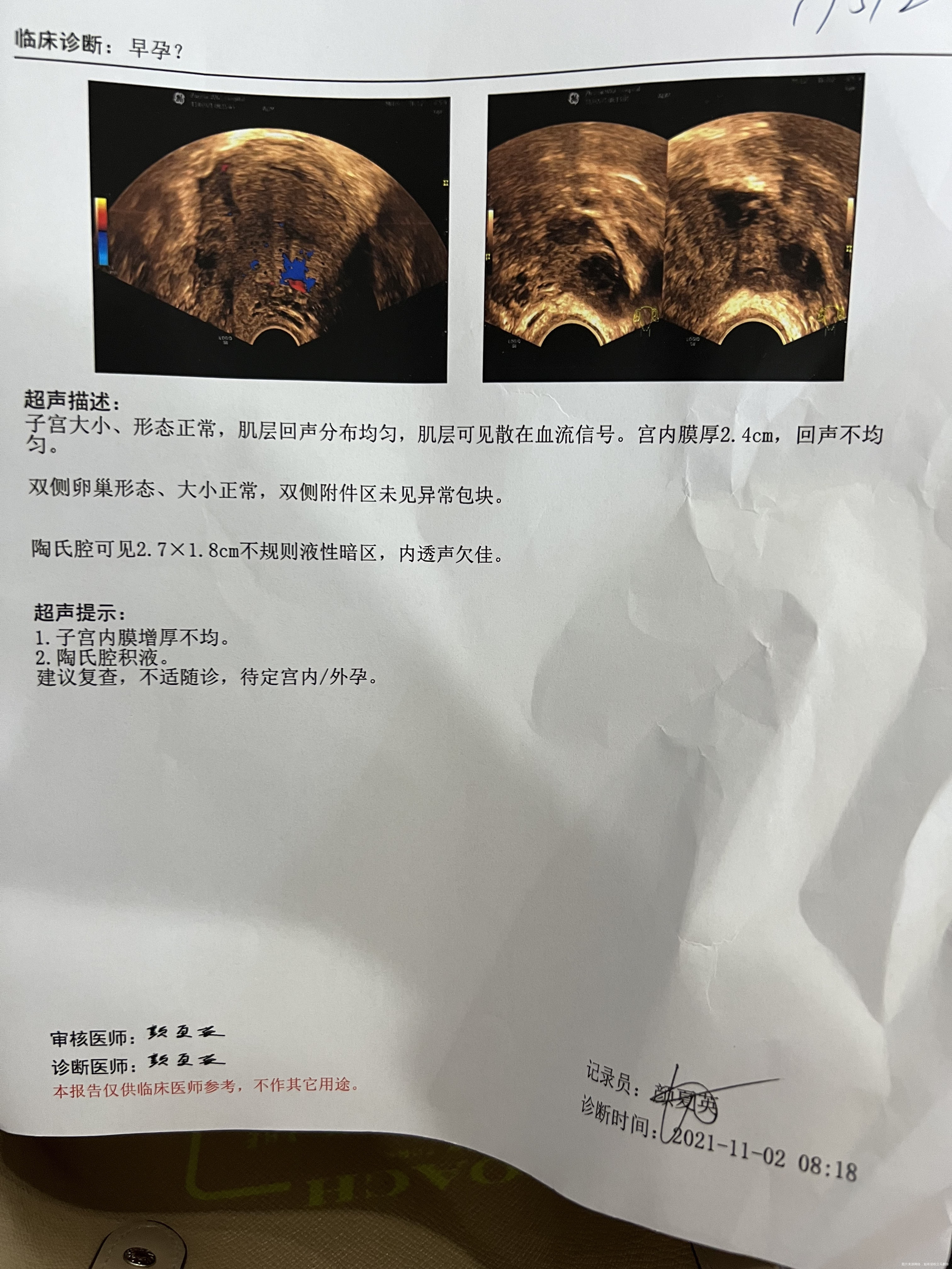 医生你好我是做一代的10月5号移植鲜胚2个1