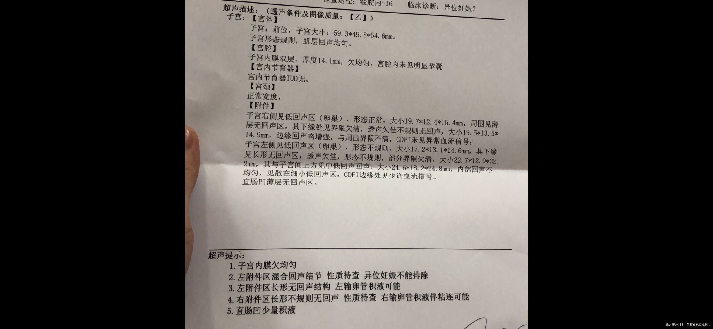 20211021号移植2021114号血值3