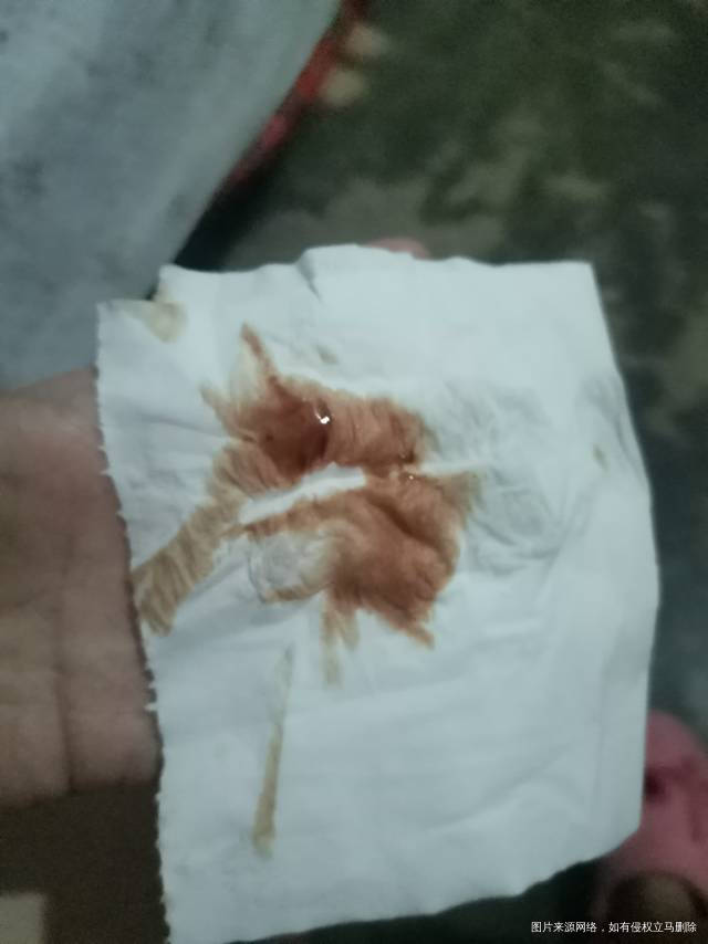 移植后62天出褐色血吃了固肾安胎丸维生素E地