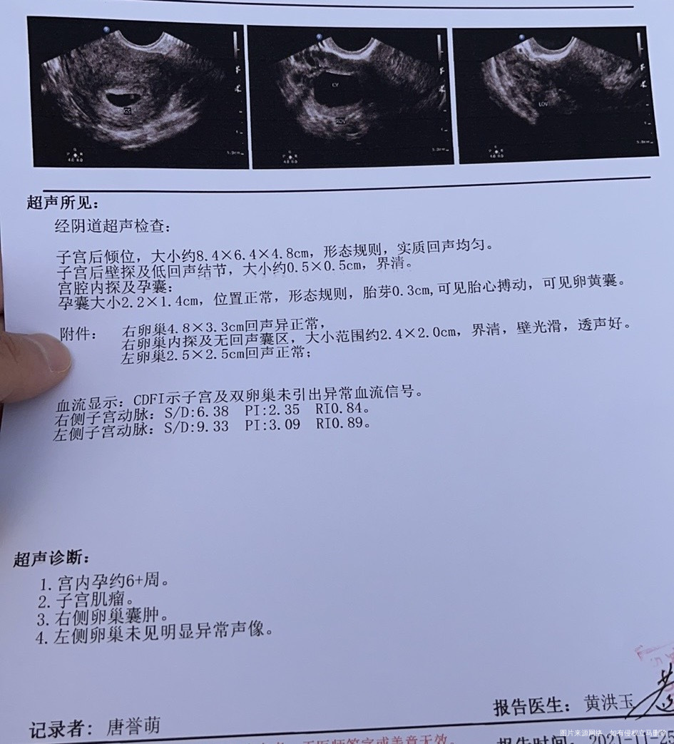 今天是移植的第28天做的检查18号的hcg是