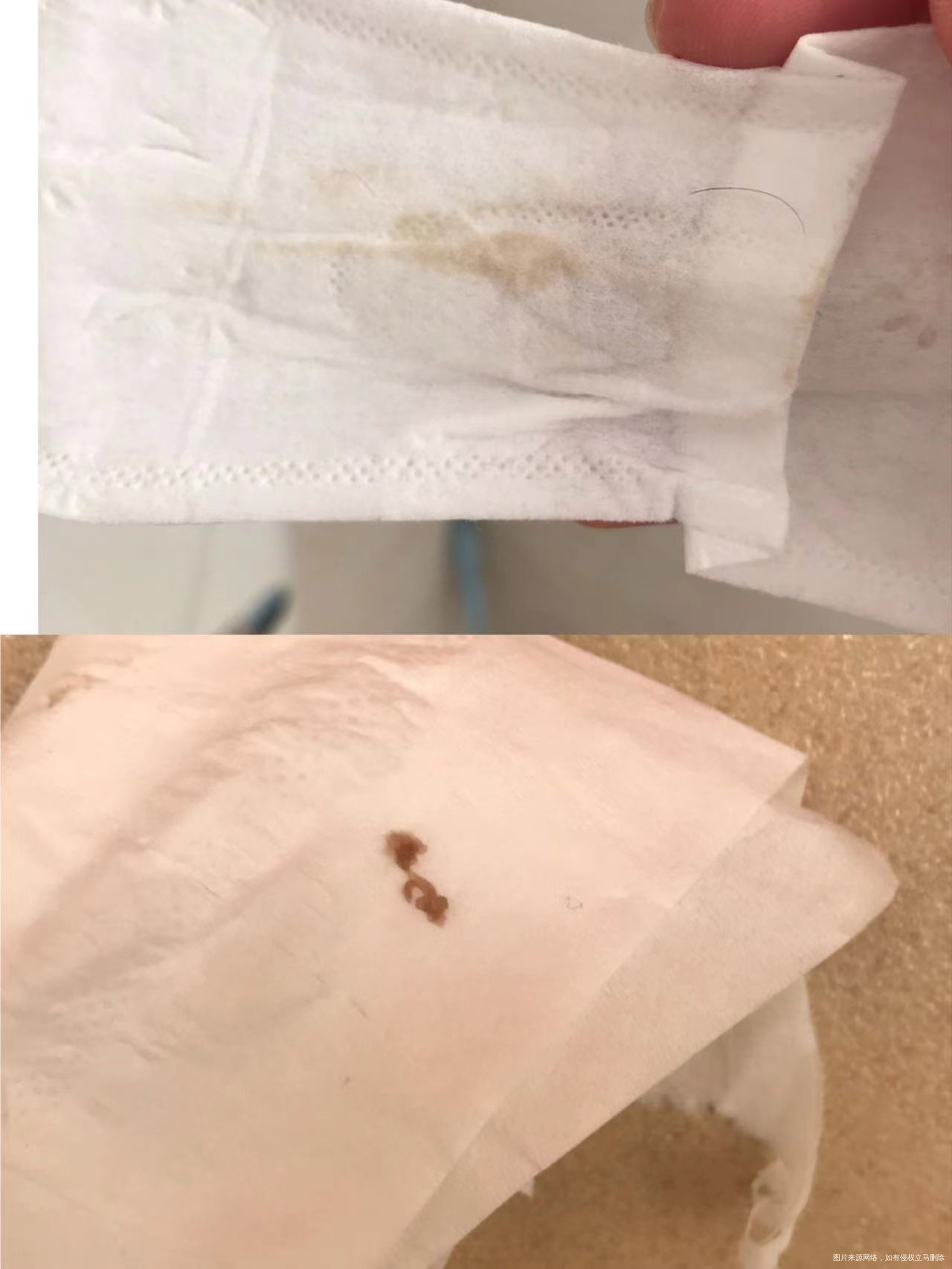 医生好!老婆末次来月经是10月10号月经周期