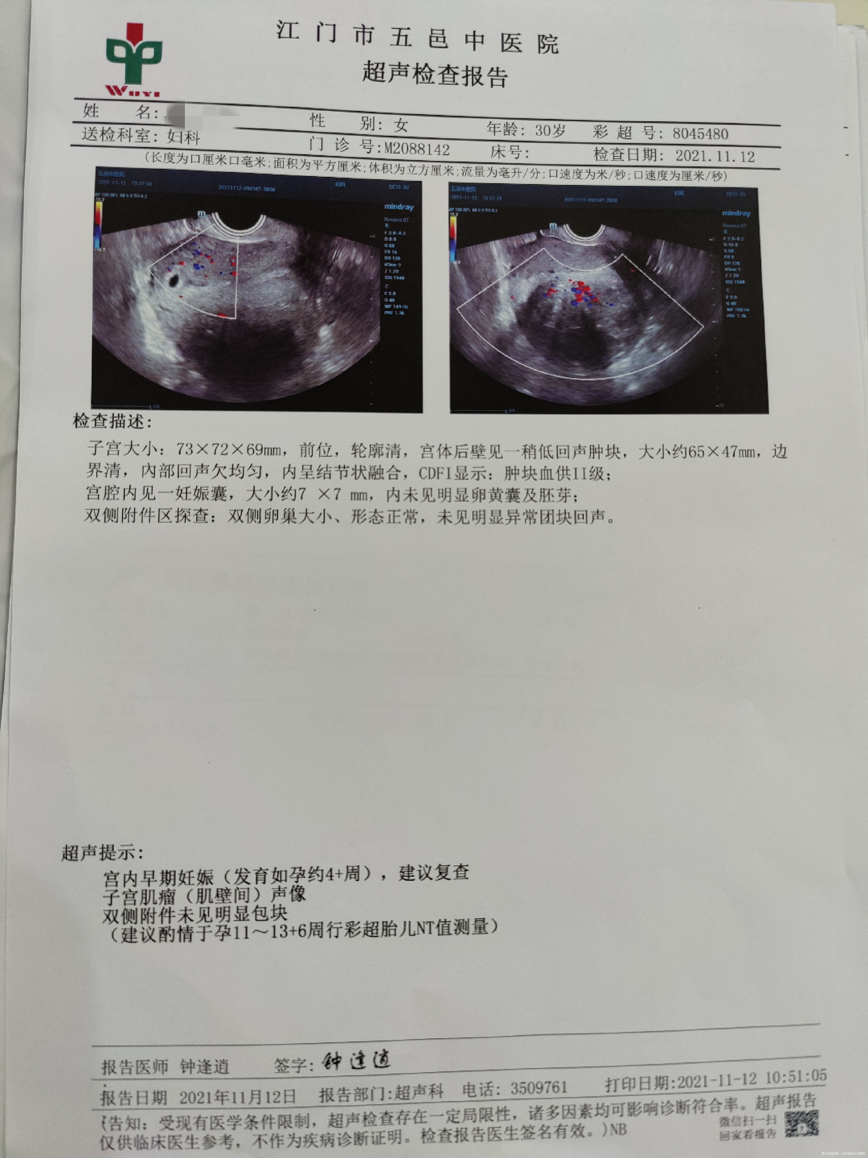 医生好!老婆末次来月经是10月10号月经周期