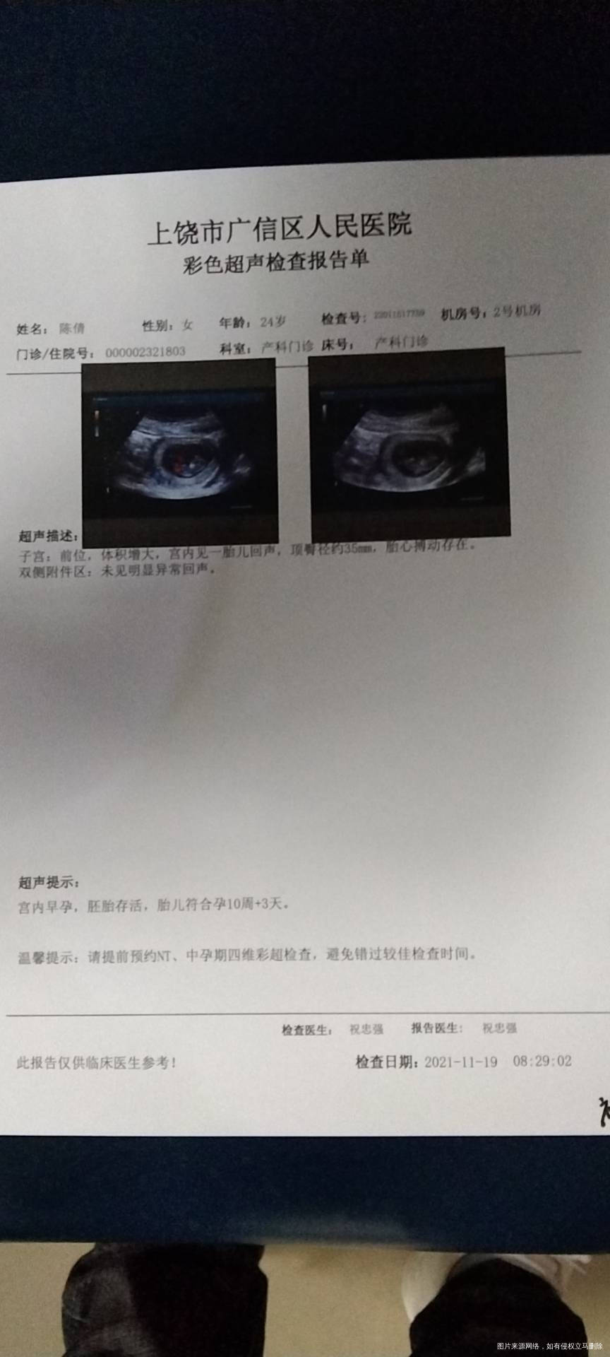 今天做b超没有显示宫腔积液是吸收了吗