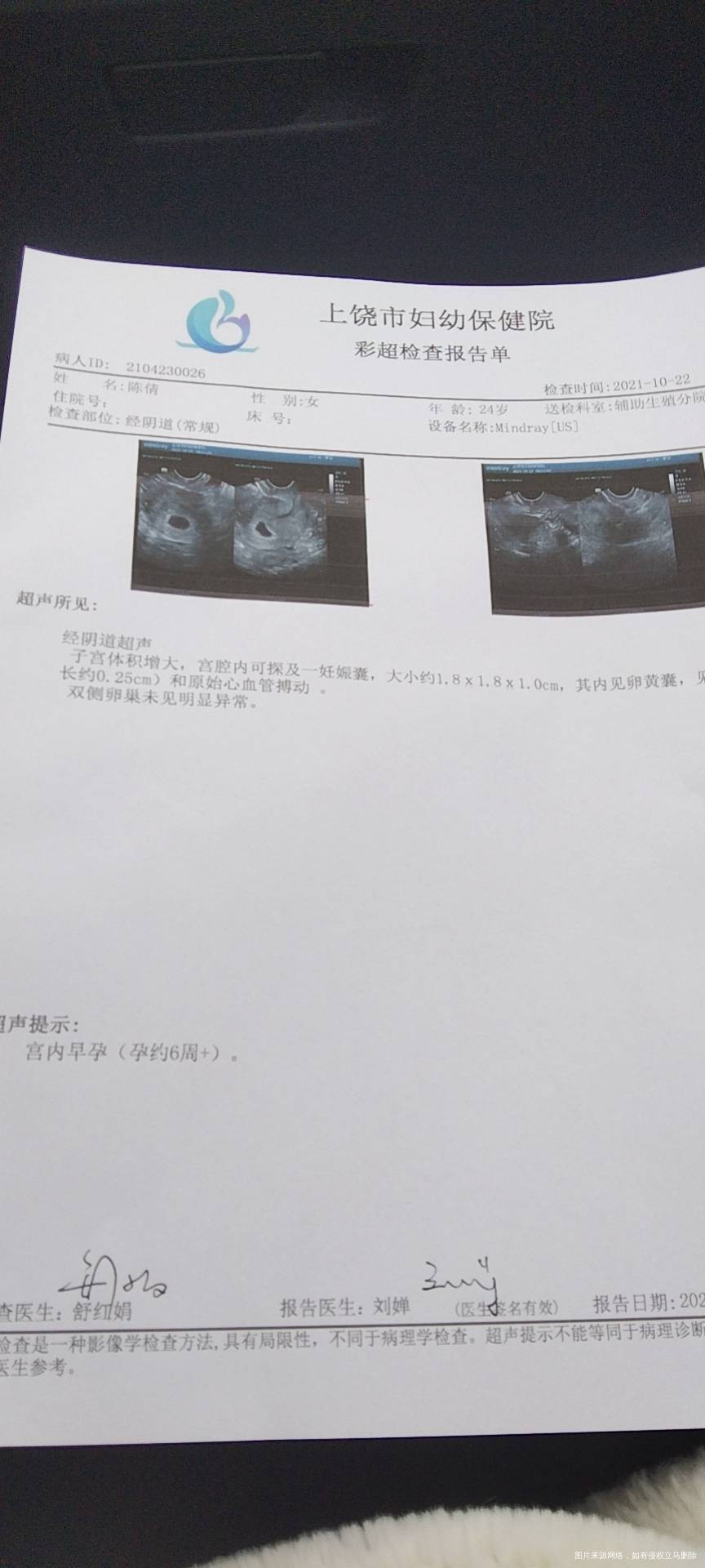 医生怀孕8周这样正常吗有宫腔积液?