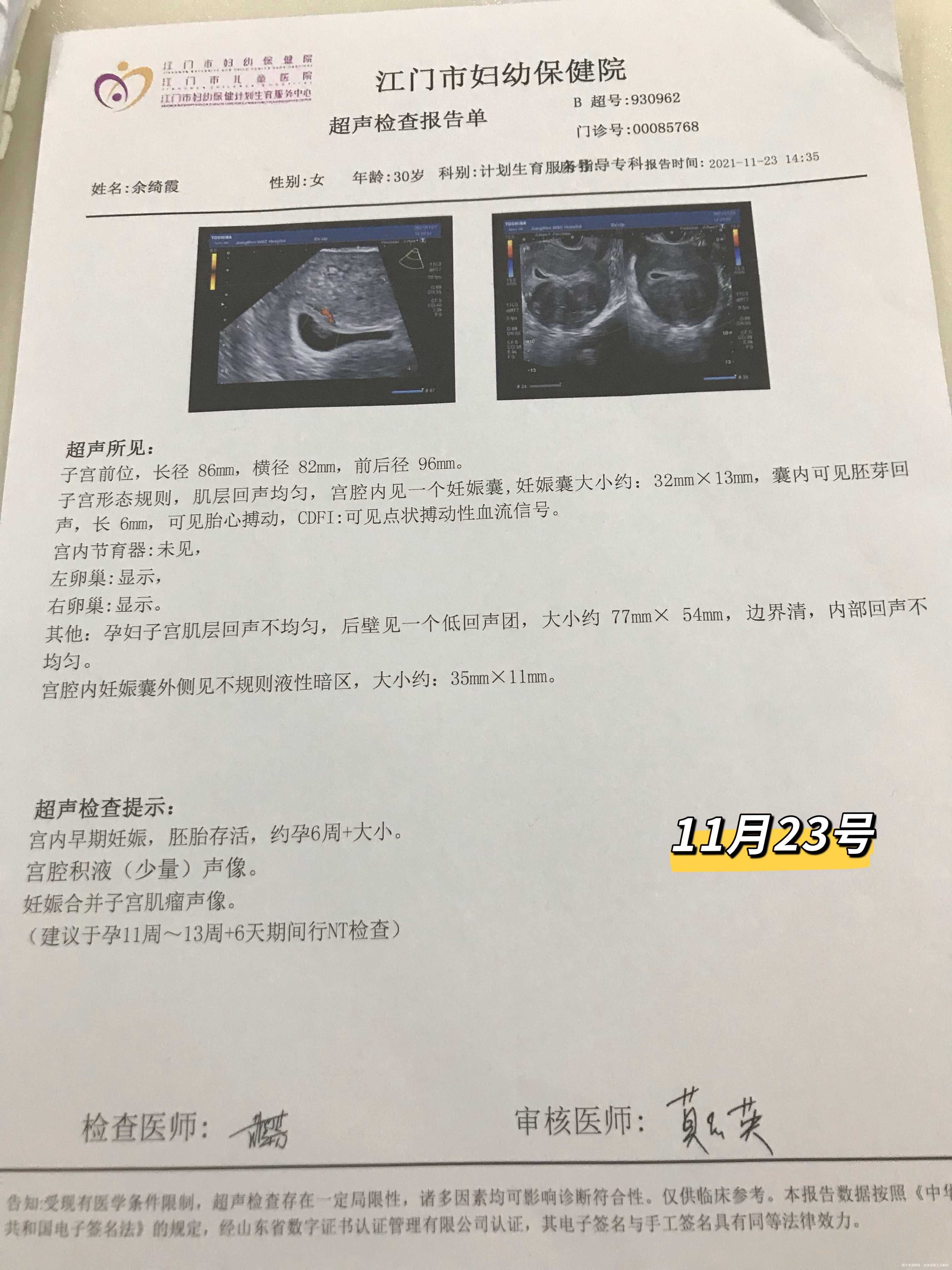 医生好末次月经10月10号今天孕6周+4天断