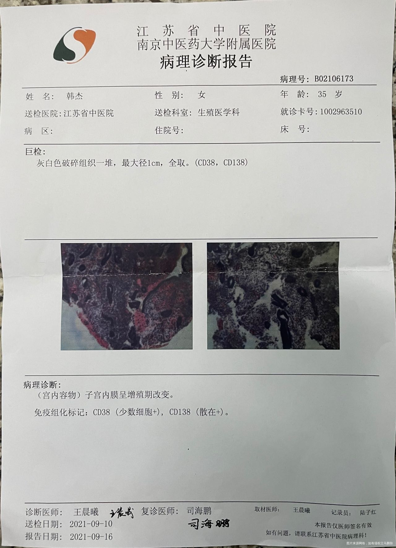 请问灌肠了四十天还需要宫腔镜复查吗