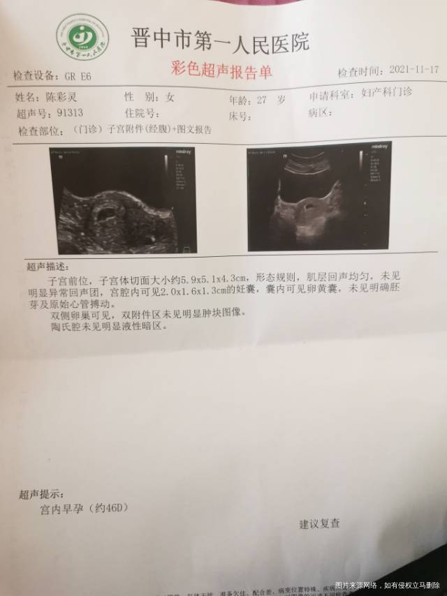 你好医生末次月经9月19日11月17日检查可