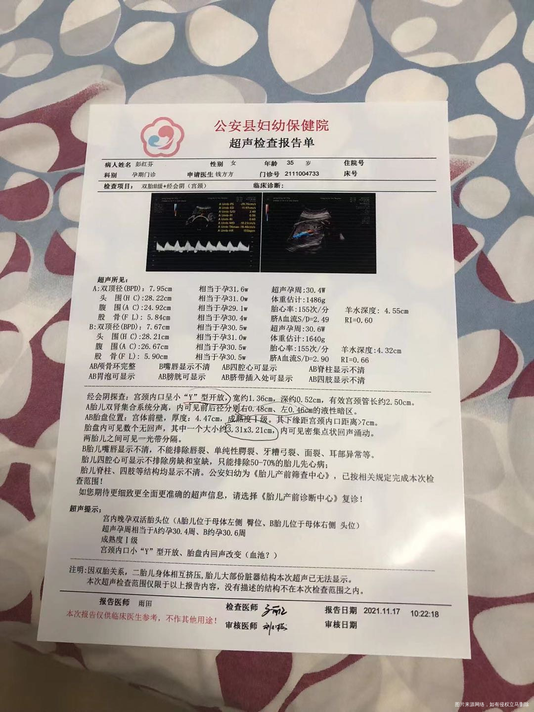 麻烦医生帮我看看这个需要住院保胎吗