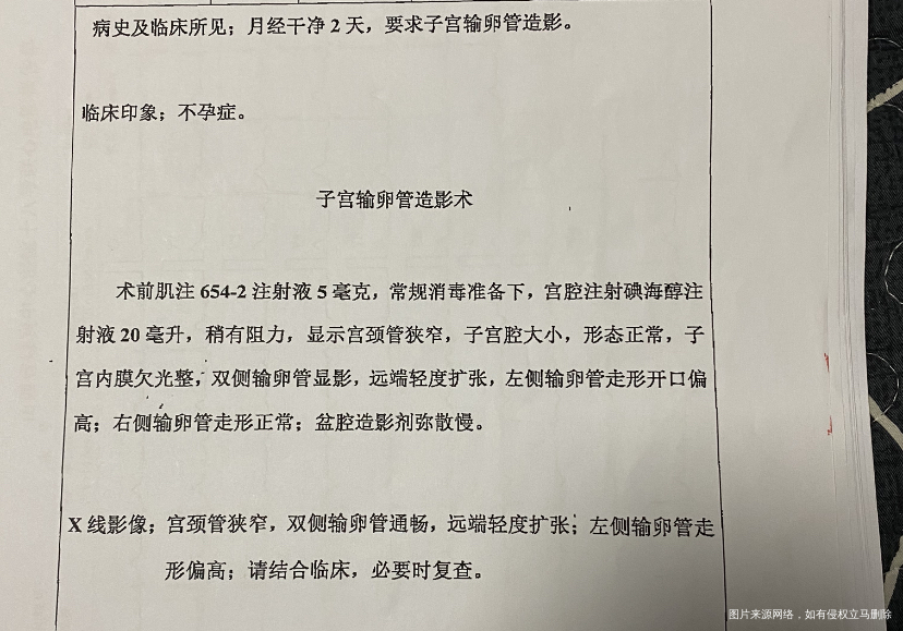 大夫你好我做了宫腹腔手术说是卵巢冠囊肿没有积