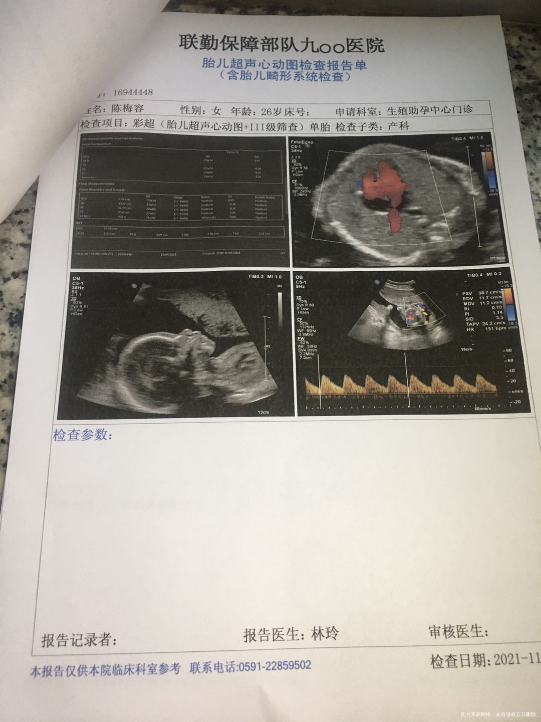 你好医生我这宫颈是不是太短了