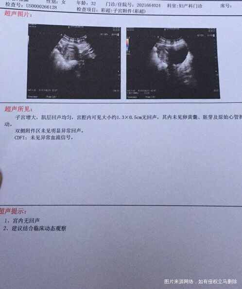 莫次月经10月24号11月19号出血以为是月