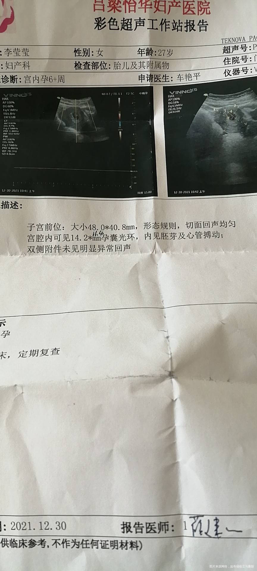 麻烦看一下血值和孕酮还有b超单看一下啥情况