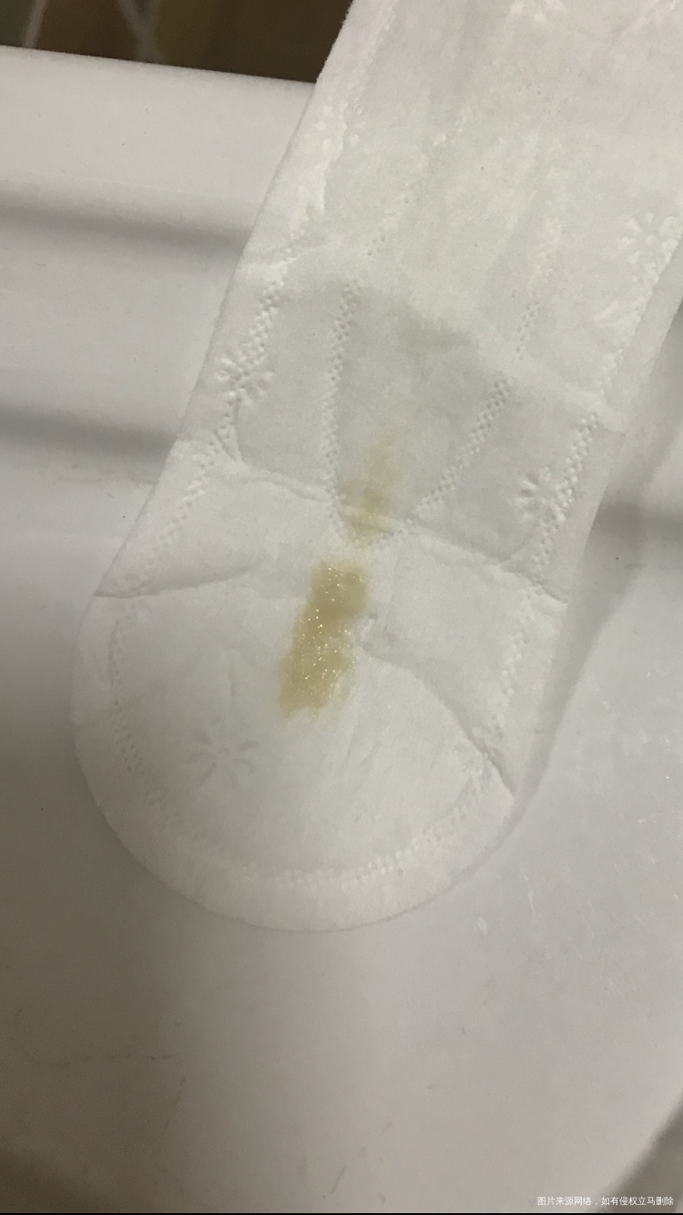 末次月经10月10号孕5周开始断断续续有褐色