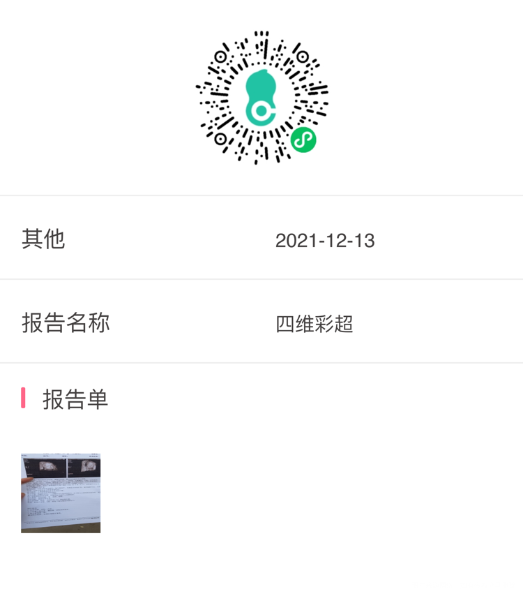 请问有什么问题吗三尖瓣返流问题大吗