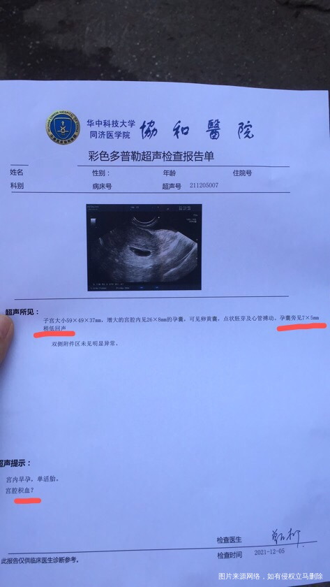 今天做的b超请问医生那个稍低回声是什么