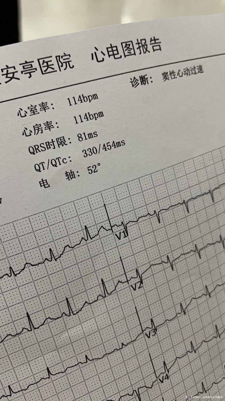 老师们我下个星期做剖腹产手术今天做了心脏彩超