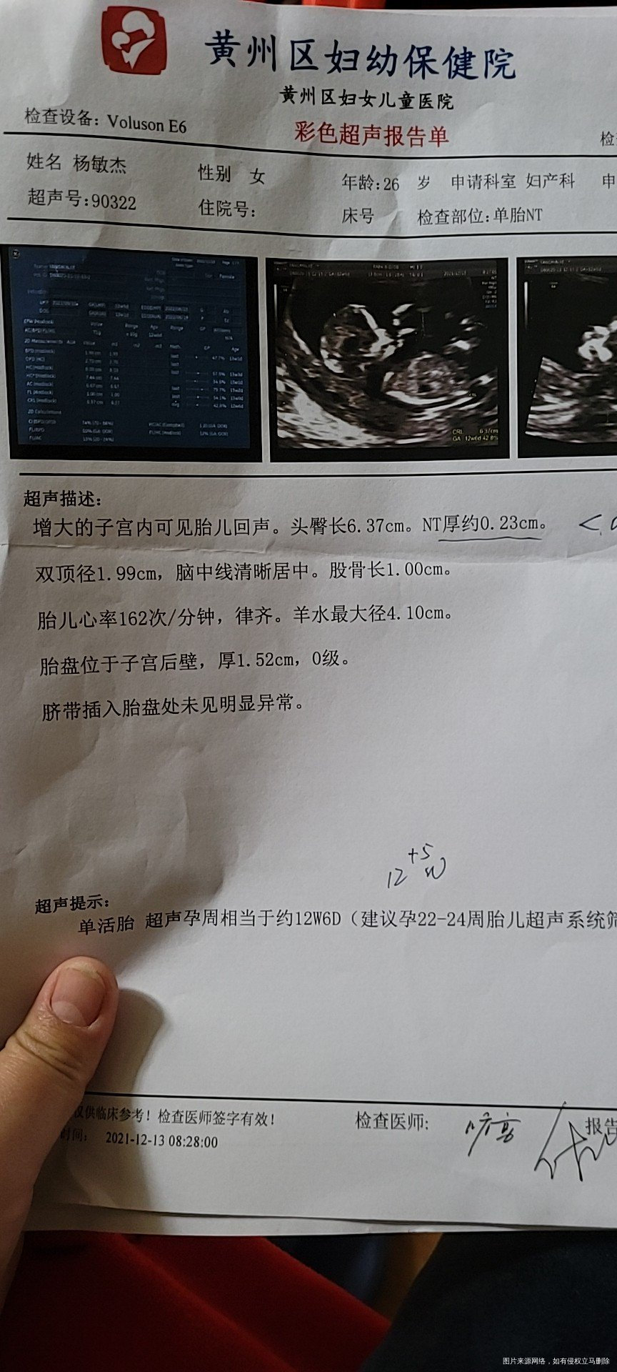 请帮我看一下nt报告正不正常