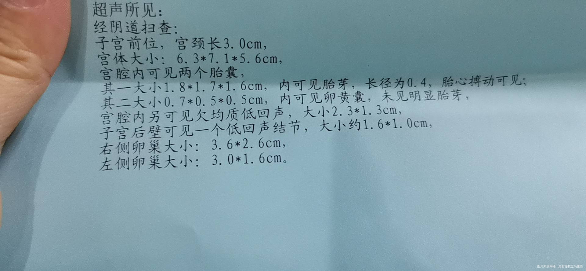 医生麻烦看看这报告这两天有一点红褐色还想吐一