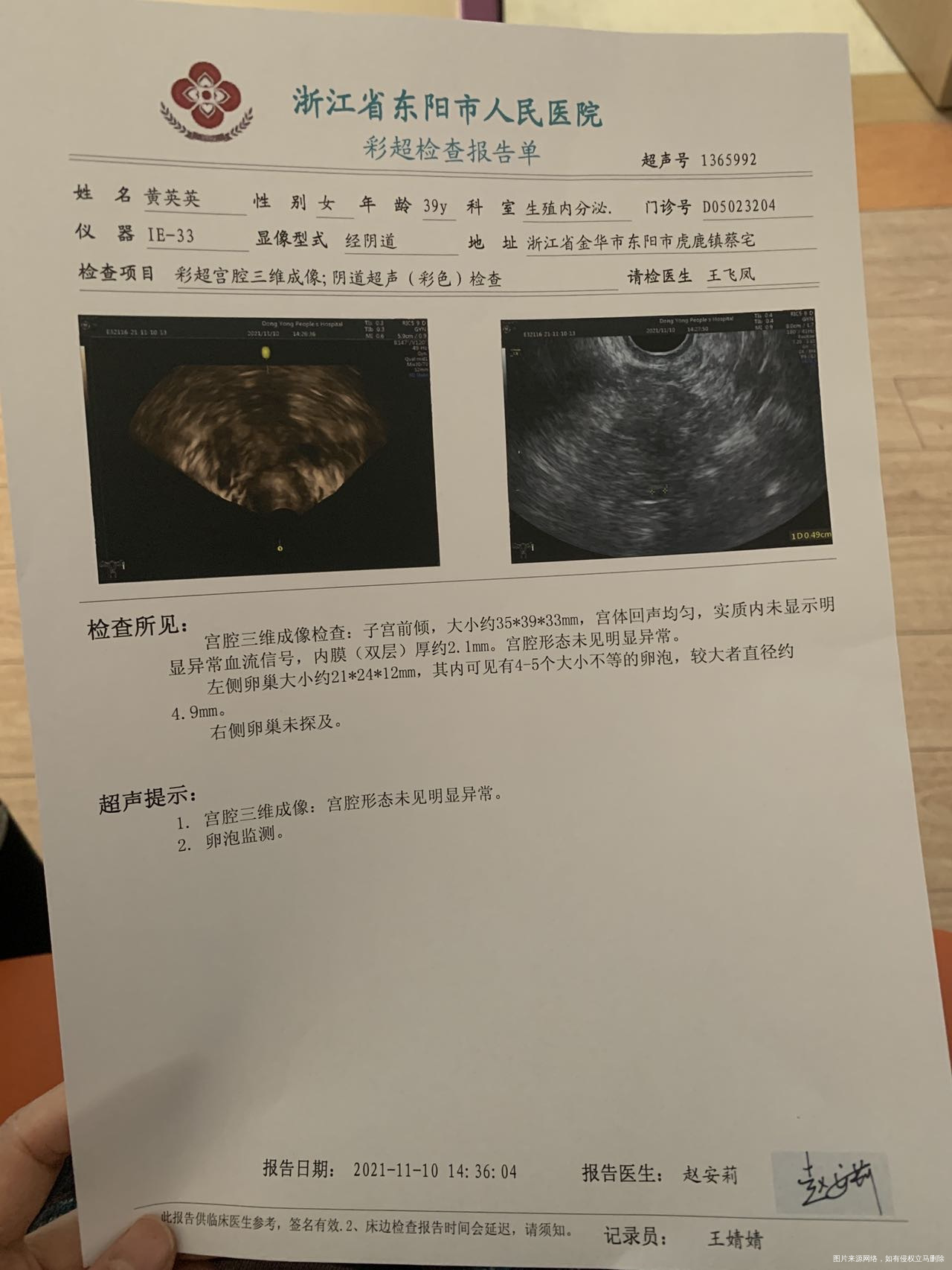 一次冻胚移植生化一次鲜胚移植没着床两次失败后