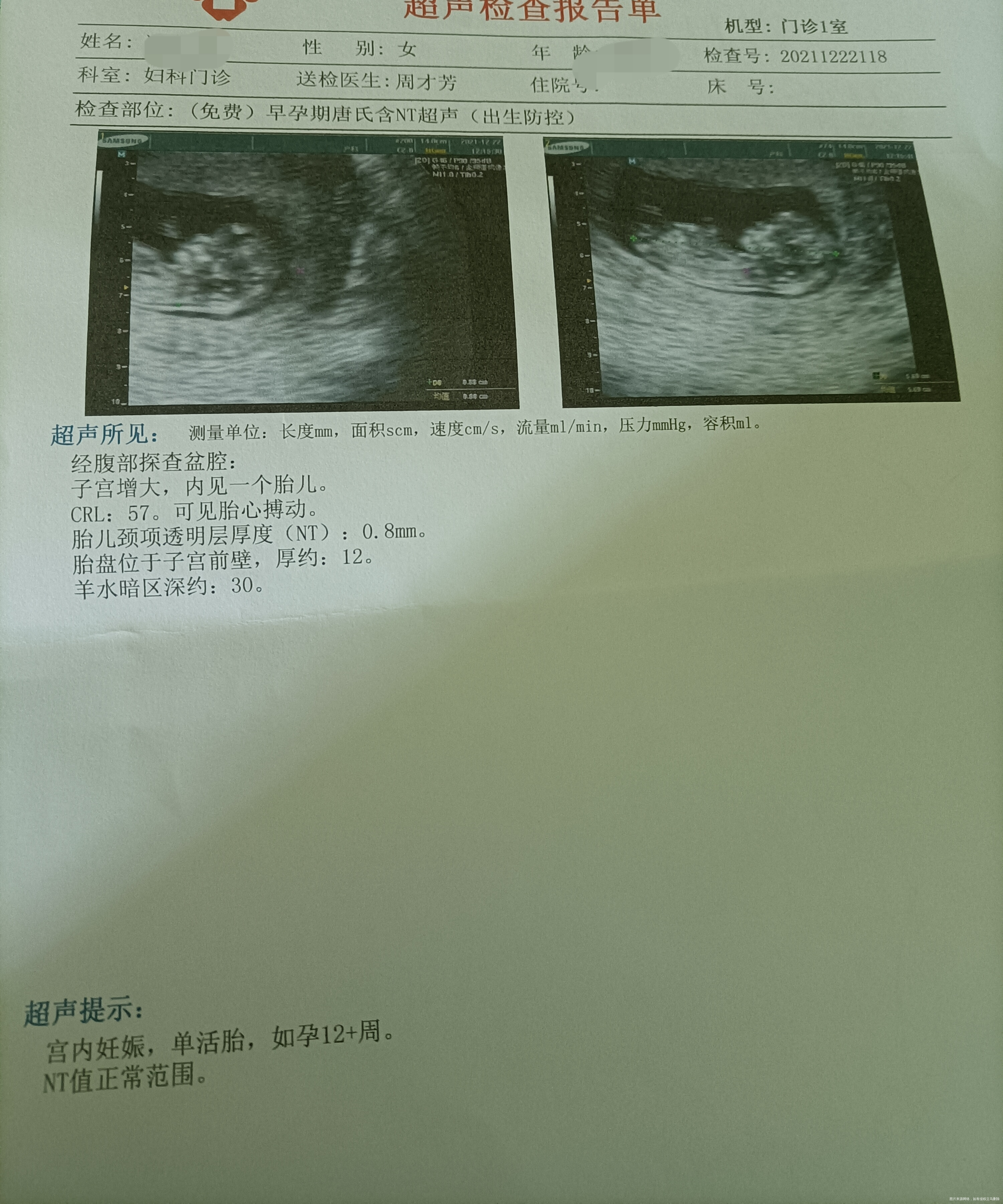 医生你好麻烦帮我看看这份报告胎盘位于子宫前壁