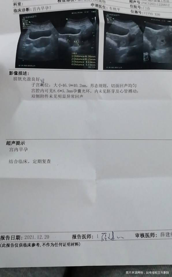 怀孕第38天一早b超检查了宫内早孕麻烦看一下