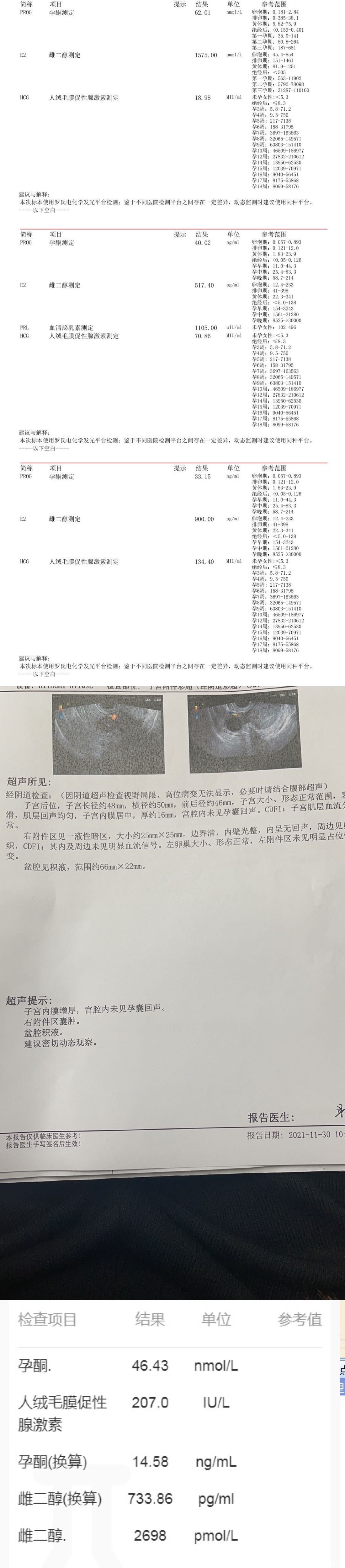 这样的情况是胎停了吗还是生化最后一张hcg是